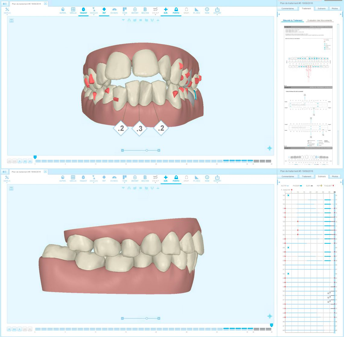 Analyse en orthodontie digitale