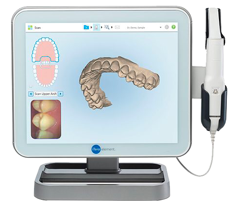 Radio d'une dentition en orthodontie digitale